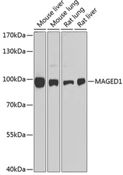 Anti-MAGED1 antibody used in Western Blot (WB). GTX54316