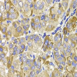 Anti-MAGED1 antibody used in IHC (Paraffin sections) (IHC-P). GTX54316