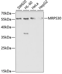 Anti-MRPS30 antibody used in Western Blot (WB). GTX54320