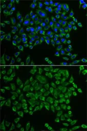 Anti-MRPS30 antibody used in Immunocytochemistry/ Immunofluorescence (ICC/IF). GTX54320