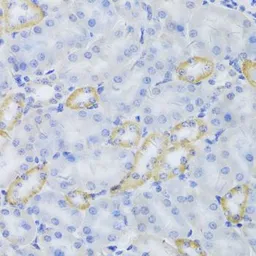 Anti-MRPS30 antibody used in IHC (Paraffin sections) (IHC-P). GTX54320