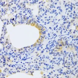 Anti-MRPS30 antibody used in IHC (Paraffin sections) (IHC-P). GTX54320