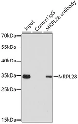 Anti-MRPL28 antibody used in Immunoprecipitation (IP). GTX54321