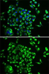 Anti-MRPL28 antibody used in Immunocytochemistry/ Immunofluorescence (ICC/IF). GTX54321
