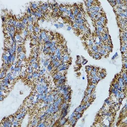 Anti-MRPL28 antibody used in IHC (Paraffin sections) (IHC-P). GTX54321