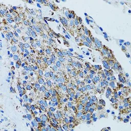 Anti-MRPL28 antibody used in IHC (Paraffin sections) (IHC-P). GTX54321