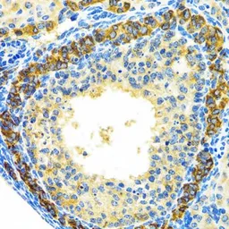 Anti-MRPL28 antibody used in IHC (Paraffin sections) (IHC-P). GTX54321