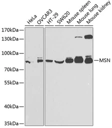 Anti-Moesin antibody used in Western Blot (WB). GTX54327