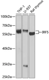 Anti-IRF5 antibody used in Western Blot (WB). GTX54336