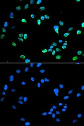 Anti-IRF5 antibody used in Immunocytochemistry/ Immunofluorescence (ICC/IF). GTX54336