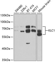 Anti-KLC1 antibody used in Western Blot (WB). GTX54339