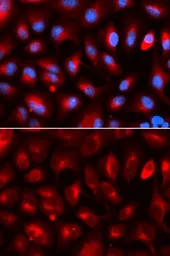 Anti-KLC1 antibody used in Immunocytochemistry/ Immunofluorescence (ICC/IF). GTX54339