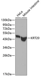 Anti-Cytokeratin 20 antibody used in Western Blot (WB). GTX54340
