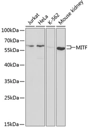 Anti-MITF antibody used in Western Blot (WB). GTX54344