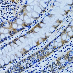 Anti-IMPA1 antibody used in IHC (Paraffin sections) (IHC-P). GTX54348