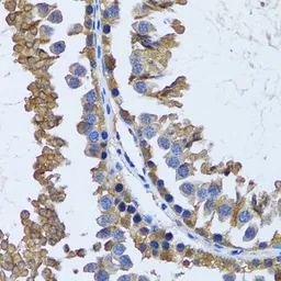 Anti-IMPA1 antibody used in IHC (Paraffin sections) (IHC-P). GTX54348