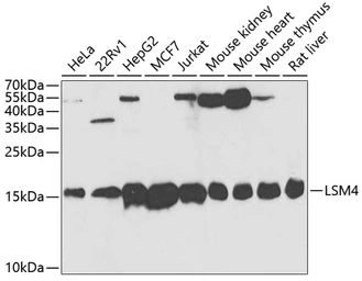 Anti-LSM4 antibody used in Western Blot (WB). GTX54350