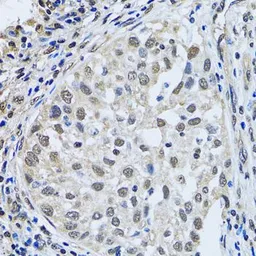 Anti-LSM4 antibody used in IHC (Paraffin sections) (IHC-P). GTX54350