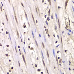 Anti-LSM4 antibody used in IHC (Paraffin sections) (IHC-P). GTX54350