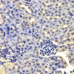 Anti-LSM4 antibody used in IHC (Paraffin sections) (IHC-P). GTX54350