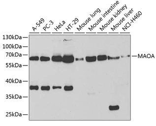 Anti-Monoamine Oxidase A antibody used in Western Blot (WB). GTX54351