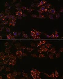 Anti-Monoamine Oxidase A antibody used in Immunocytochemistry/ Immunofluorescence (ICC/IF). GTX54351