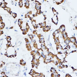 Anti-Monoamine Oxidase A antibody used in IHC (Paraffin sections) (IHC-P). GTX54351