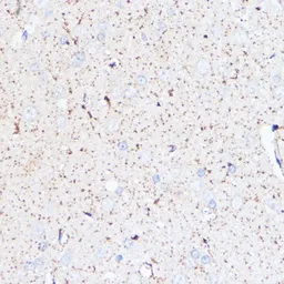 Anti-Monoamine Oxidase A antibody used in IHC (Paraffin sections) (IHC-P). GTX54351