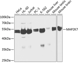 Anti-MEK7 antibody used in Western Blot (WB). GTX54352