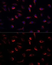 Anti-MEK7 antibody used in Immunocytochemistry/ Immunofluorescence (ICC/IF). GTX54352