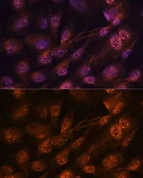 Anti-MEK7 antibody used in Immunocytochemistry/ Immunofluorescence (ICC/IF). GTX54352
