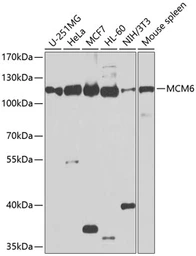 Anti-MCM6 antibody used in Western Blot (WB). GTX54353