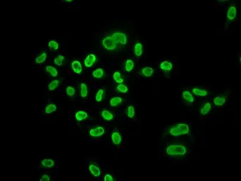 Anti-MCM6 antibody used in Immunocytochemistry/ Immunofluorescence (ICC/IF). GTX54353