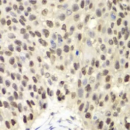 Anti-MCM6 antibody used in IHC (Paraffin sections) (IHC-P). GTX54353