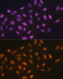 Anti-MCM7 antibody used in Immunocytochemistry/ Immunofluorescence (ICC/IF). GTX54354