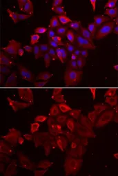 Anti-Myotilin antibody used in Immunocytochemistry/ Immunofluorescence (ICC/IF). GTX54355