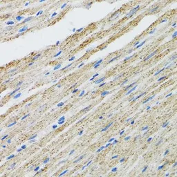 Anti-Myotilin antibody used in IHC (Paraffin sections) (IHC-P). GTX54355