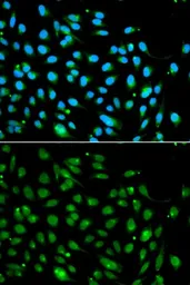 Anti-ING3 antibody used in Immunocytochemistry/ Immunofluorescence (ICC/IF). GTX54356