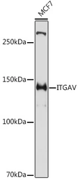 Anti-Integrin alpha V antibody used in Western Blot (WB). GTX54357