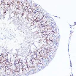 Anti-Integrin alpha V antibody used in IHC (Paraffin sections) (IHC-P). GTX54357