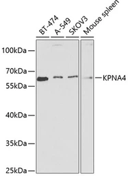 Anti-KPNA4 antibody used in Western Blot (WB). GTX54358
