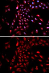 Anti-KPNA4 antibody used in Immunocytochemistry/ Immunofluorescence (ICC/IF). GTX54358