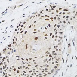 Anti-KPNA4 antibody used in IHC (Paraffin sections) (IHC-P). GTX54358