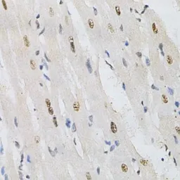 Anti-KPNA4 antibody used in IHC (Paraffin sections) (IHC-P). GTX54358