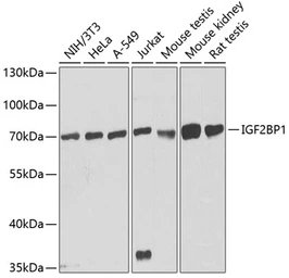 Anti-IGF2BP1 antibody used in Western Blot (WB). GTX54359