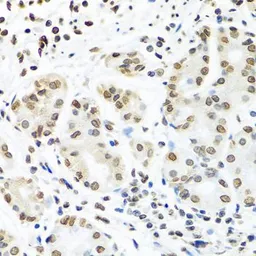 Anti-IGF2BP1 antibody used in IHC (Paraffin sections) (IHC-P). GTX54359