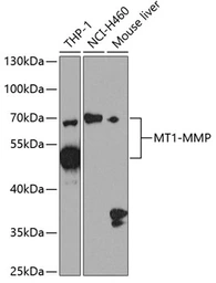 Anti-MMP14 antibody used in Western Blot (WB). GTX54361