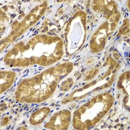 Anti-MMP14 antibody used in IHC (Paraffin sections) (IHC-P). GTX54361