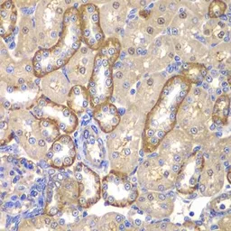 Anti-MMP14 antibody used in IHC (Paraffin sections) (IHC-P). GTX54361