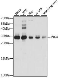 Anti-ING4 antibody used in Western Blot (WB). GTX54365